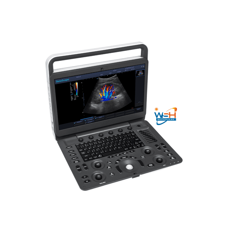e2-sonoscape-ultrasound-scanner